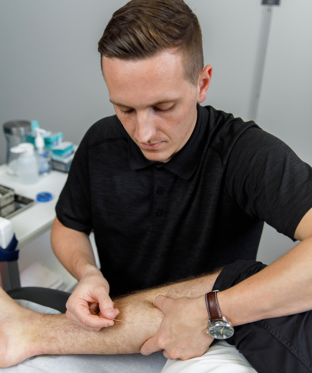 Puncture physiothérapique avec aiguilles sèches