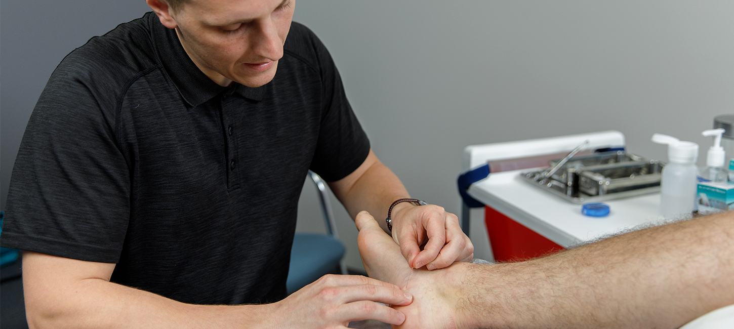 Puncture physiothérapique avec aiguilles sèches